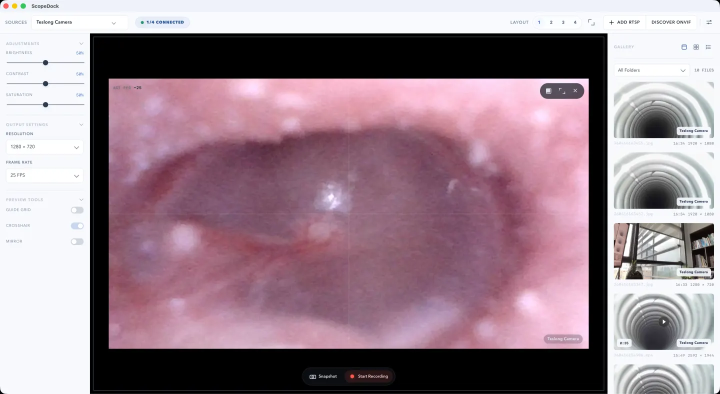 A single otoscope-style camera preview in ScopeDock on macOS