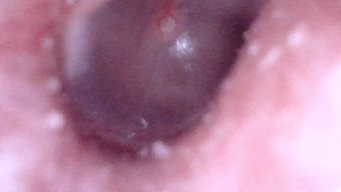 A captured otoscope-style snapshot in ScopeDock on macOS